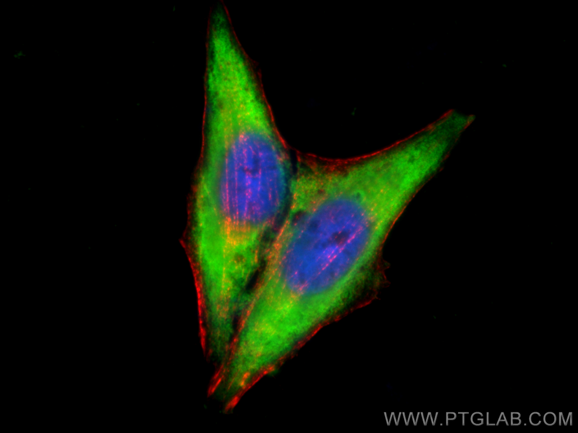 IF Staining of HepG2 using 13171-1-AP