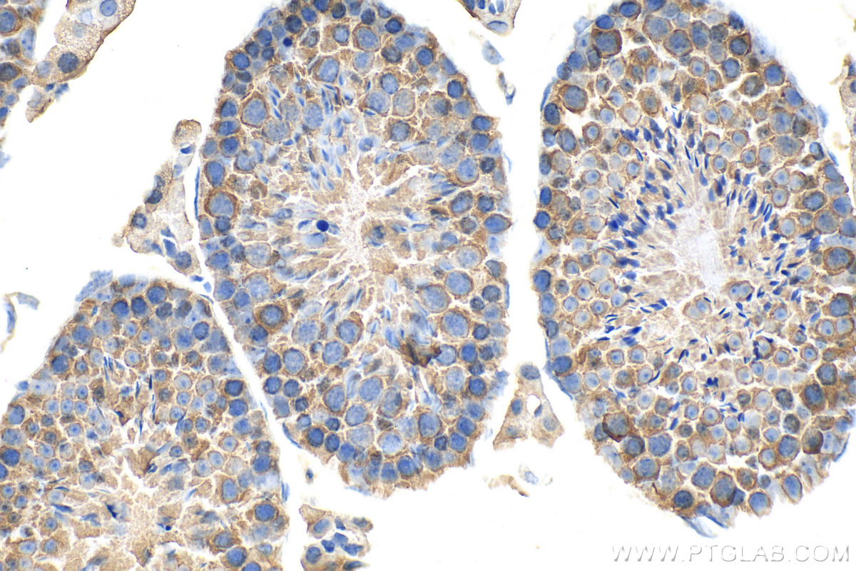 IHC staining of mouse testis using 13171-1-AP