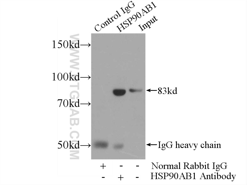 IP experiment of NIH/3T3 using 11405-1-AP