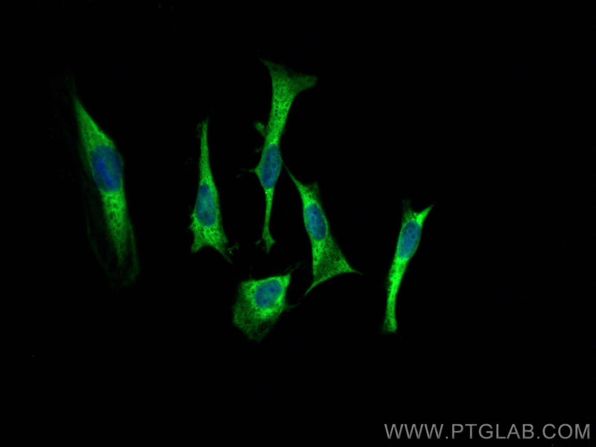 IF Staining of HeLa using 80301-1-RR