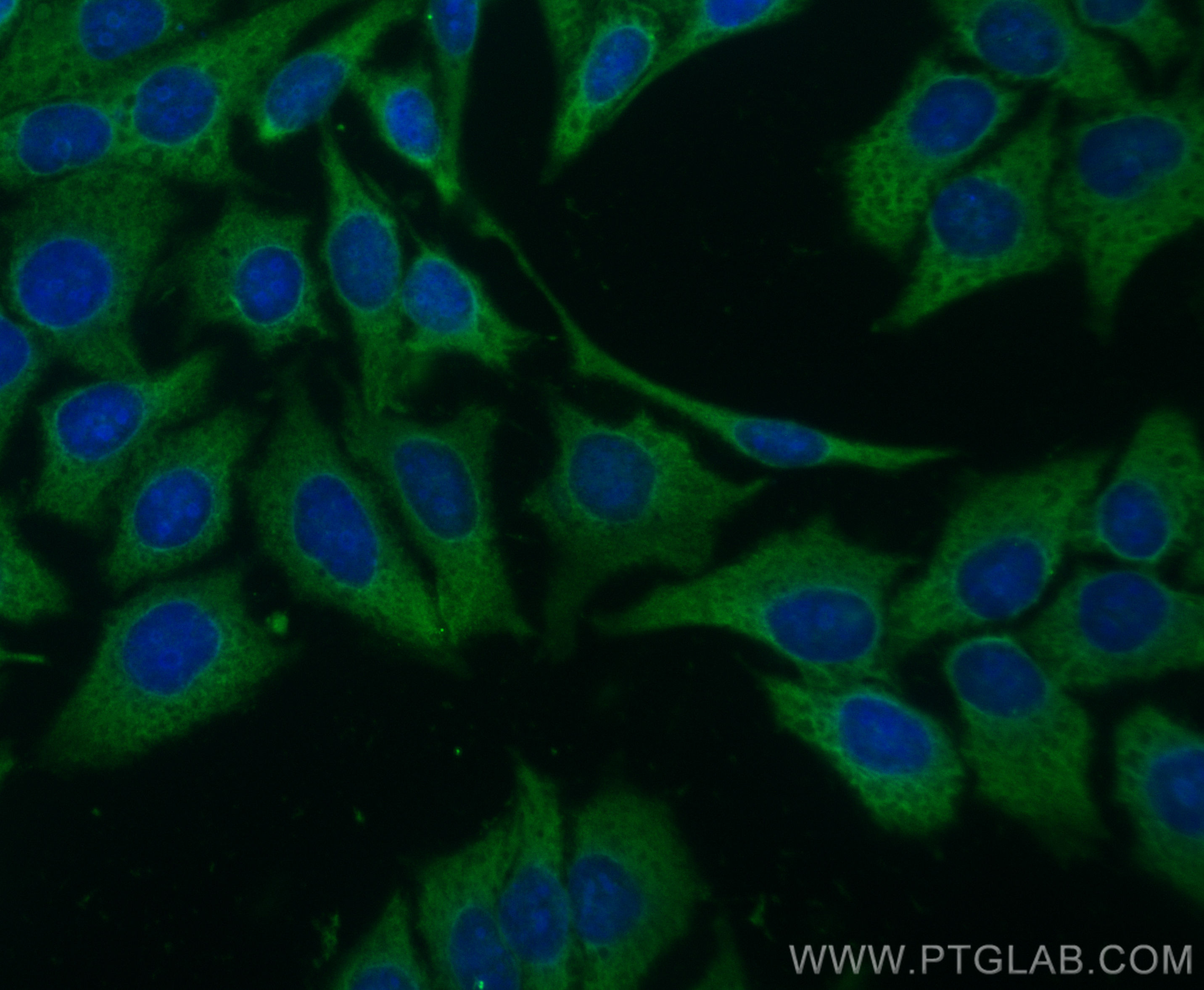 IF Staining of HepG2 using CL488-11405