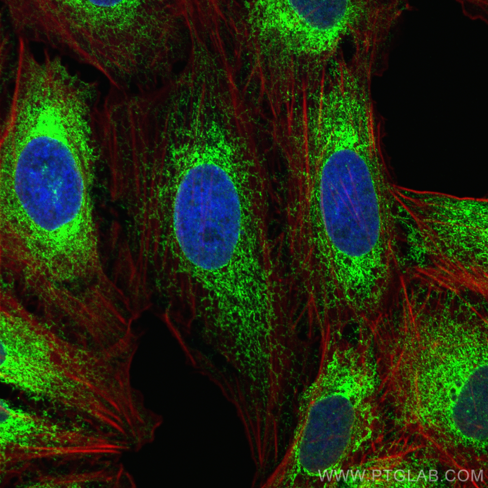 IF Staining of U2OS using 10979-1-AP