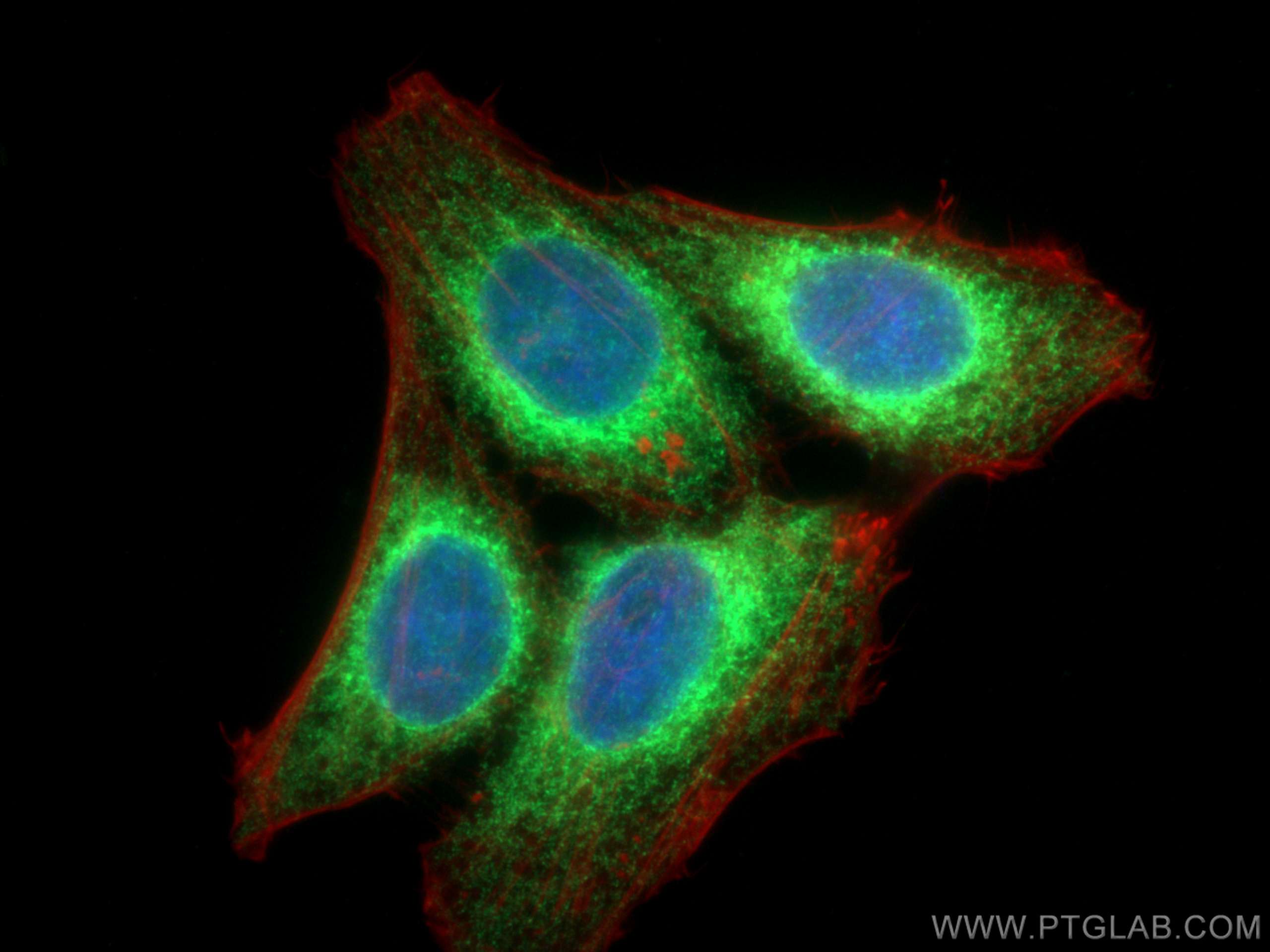 IF Staining of HepG2 using 14700-1-AP