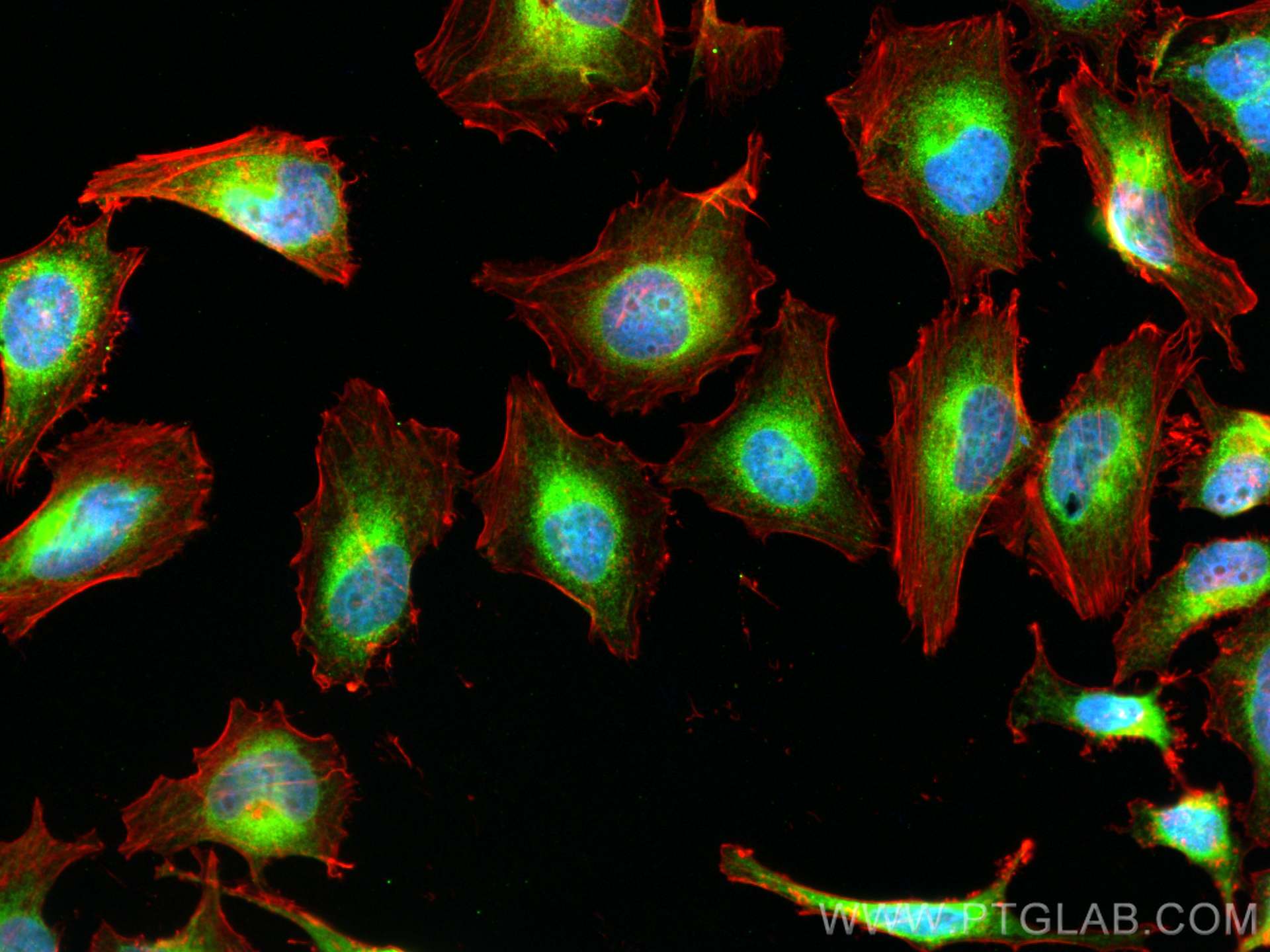 IF Staining of HeLa using 14700-1-AP