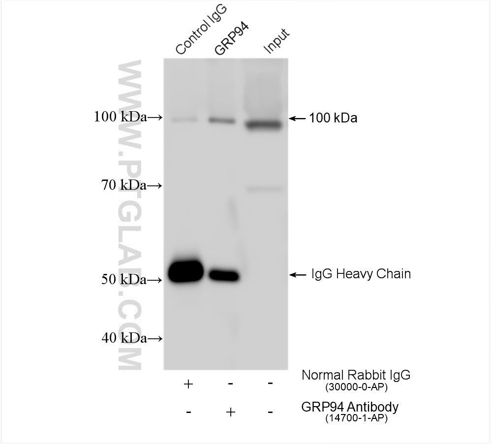 IP experiment of mouse liver using 14700-1-AP