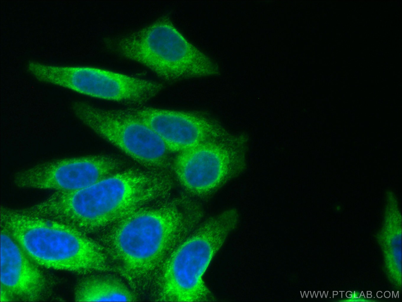 IF Staining of HepG2 using 60012-1-Ig (same clone as 60012-1-PBS)