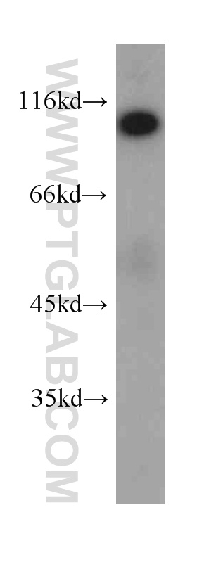 WB analysis of human heart using 60012-1-Ig (same clone as 60012-1-PBS)