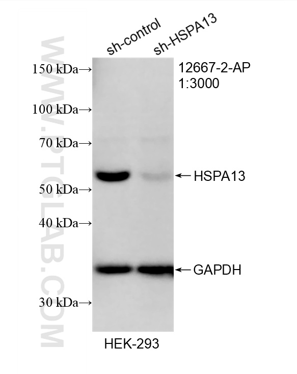 WB result of HSPA13 antibody (12667-2-AP; 1:3000; incubated at room temperature for 1.5 hours) with sh-Control and sh-HSPA13 transfected HEK-293 cells. WB analysis of HEK-293 using 12667-2-AP