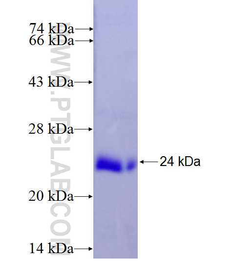 HSPA14 fusion protein Ag27411 SDS-PAGE HSPA14 fusion protein Ag27411 SDS-PAGE