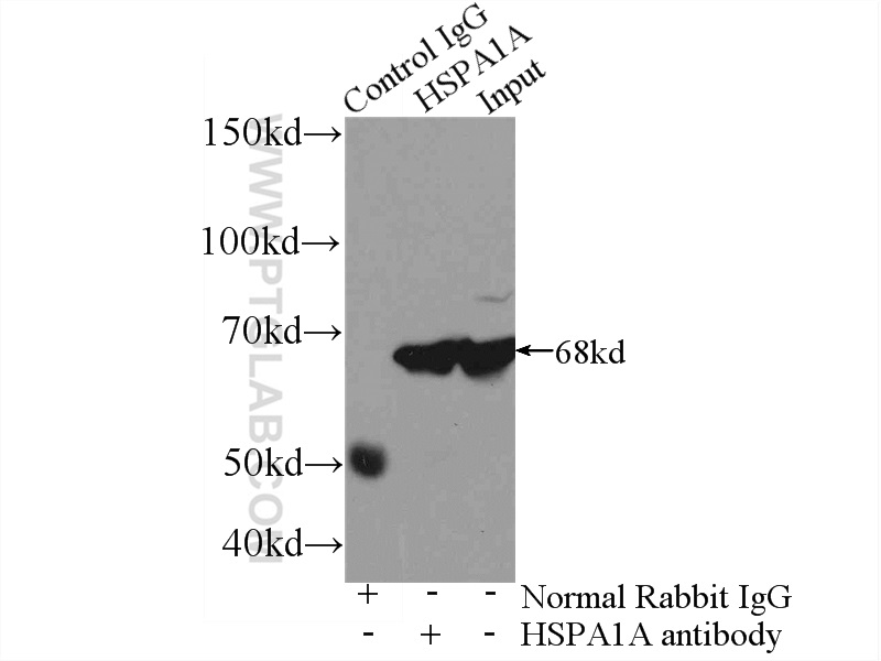 IP experiment of mouse brain using 10995-1-AP