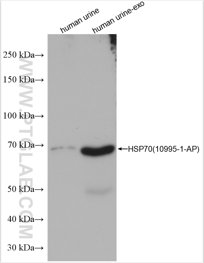 WB analysis of human urine exosomes using 10995-1-AP