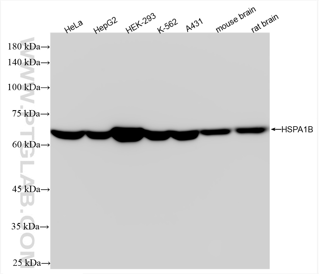 WB analysis using 84873-4-RR (same clone as 84873-4-PBS)