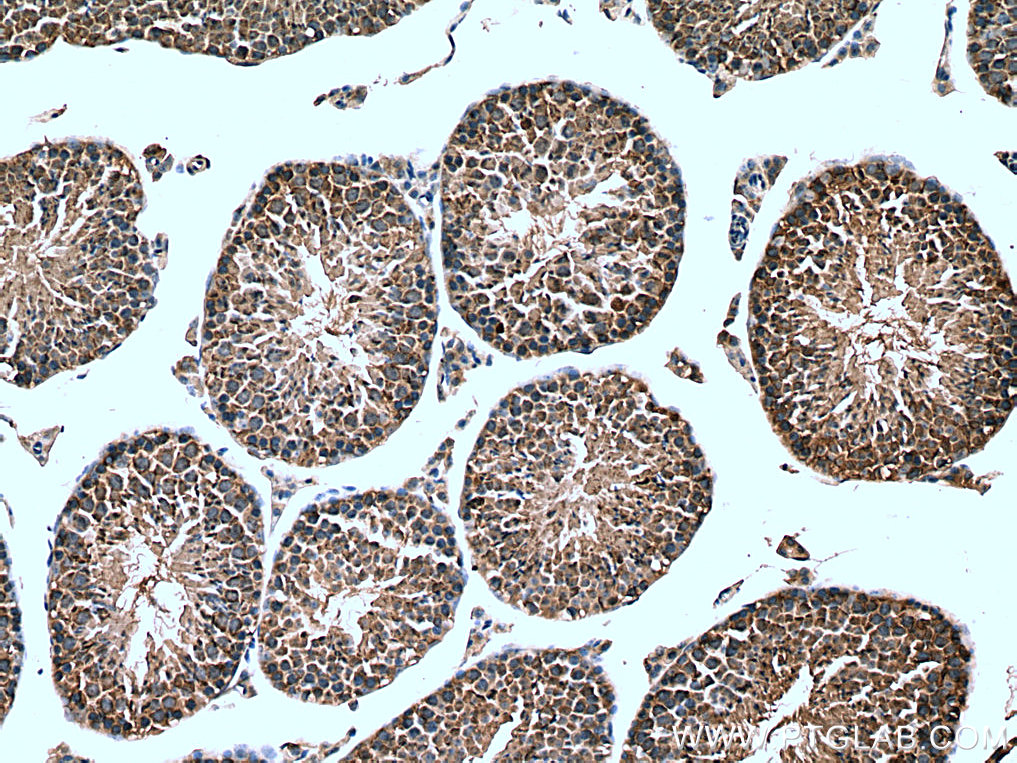 IHC staining of mouse testis using 66780-1-Ig