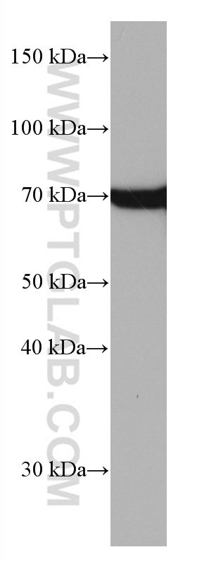 WB analysis of HeLa using 66780-1-Ig