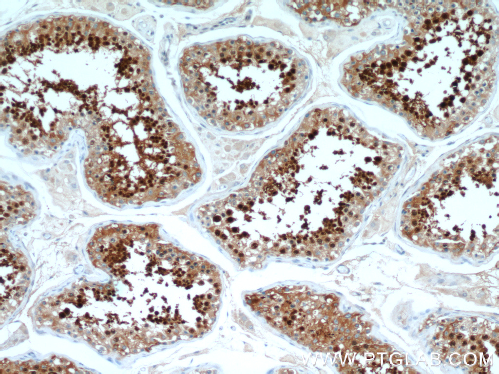 IHC staining of human testis using 12797-1-AP