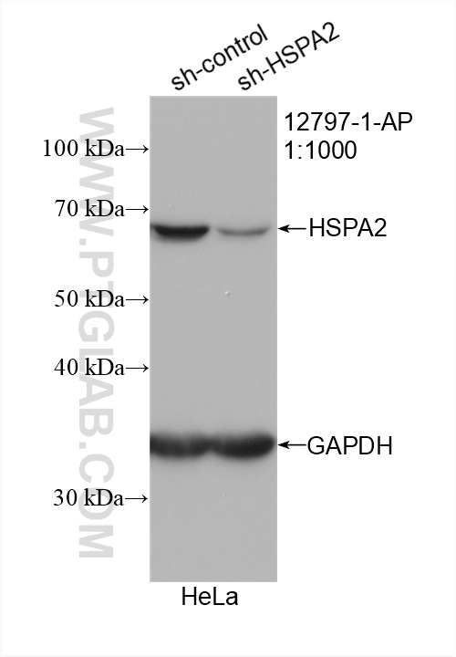 WB analysis of HeLa using 12797-1-AP