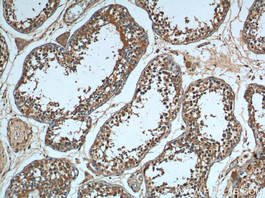 IHC staining of human testis using 66291-1-Ig