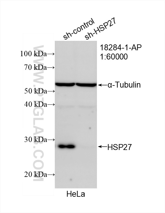 WB analysis of HeLa using 18284-1-AP