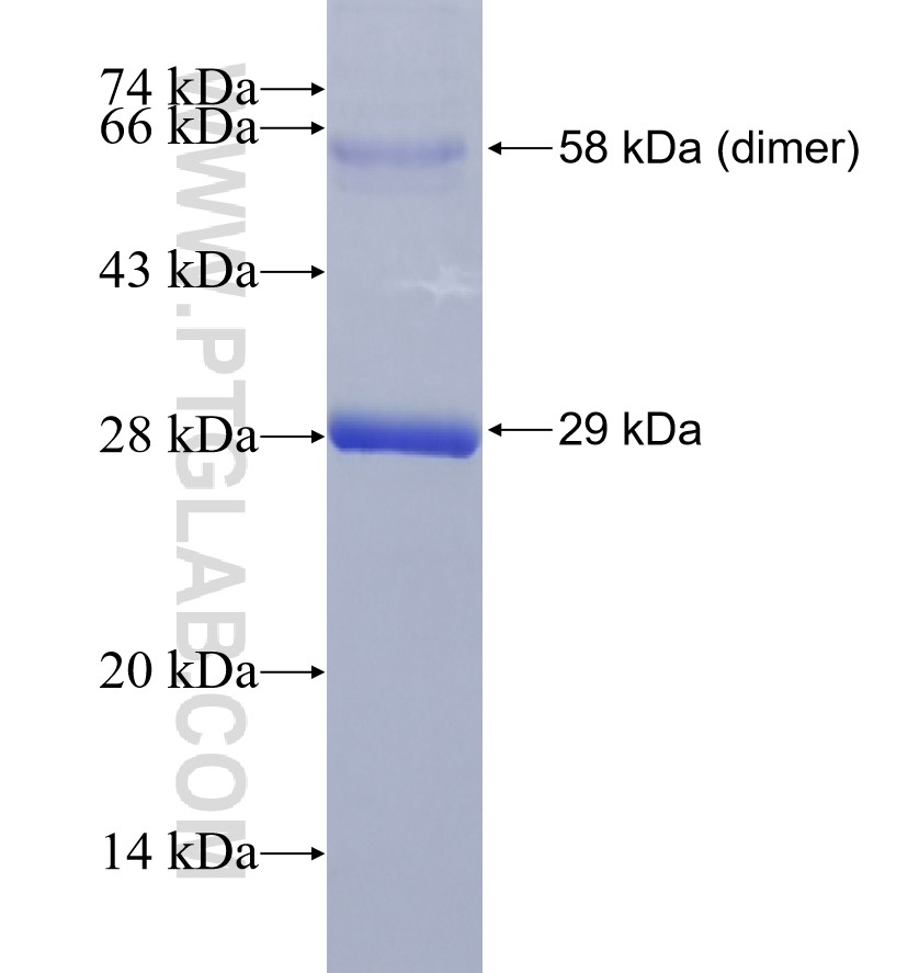 HSPB1 fusion protein Ag27859 SDS-PAGE