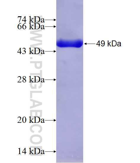 HSPB1 fusion protein Ag13161 SDS-PAGE