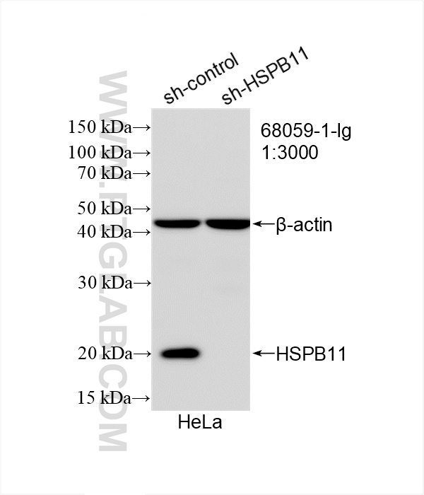 WB analysis of HeLa using 68059-1-Ig