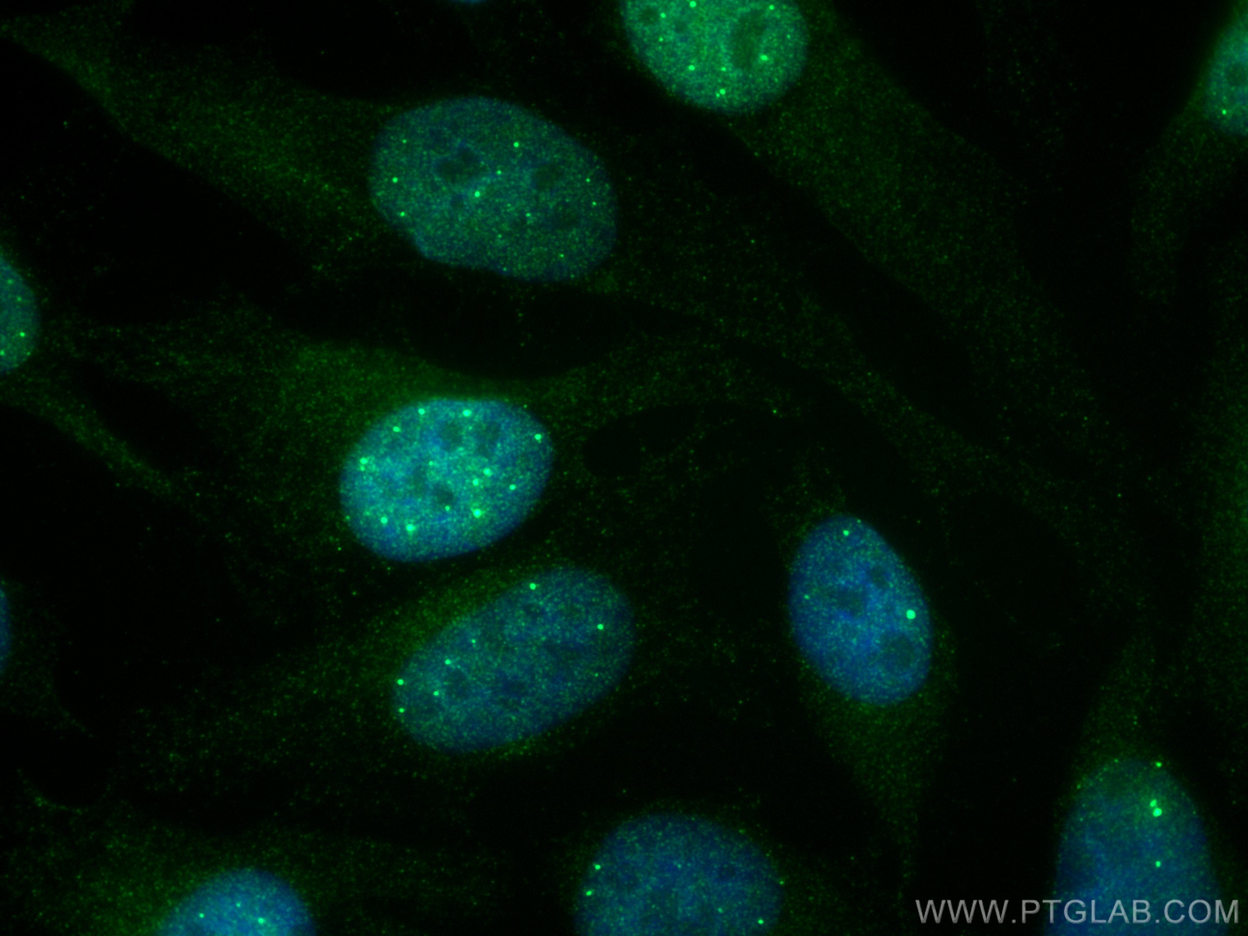 IF Staining of HeLa using 67890-1-Ig