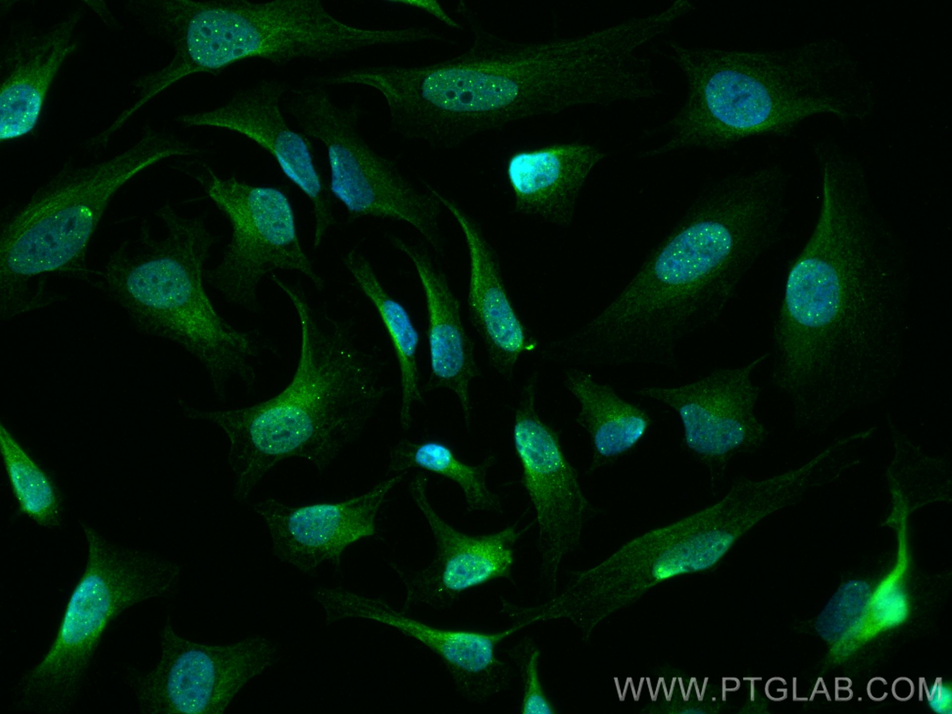 IF Staining of HeLa using 67890-1-Ig