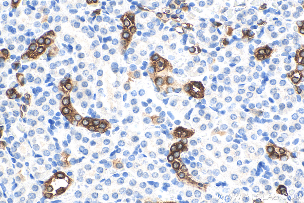 IHC staining of mouse kidney using 67890-1-Ig