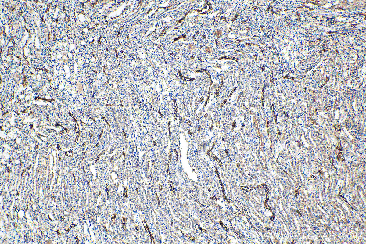 IHC staining of rat kidney using 67890-1-Ig