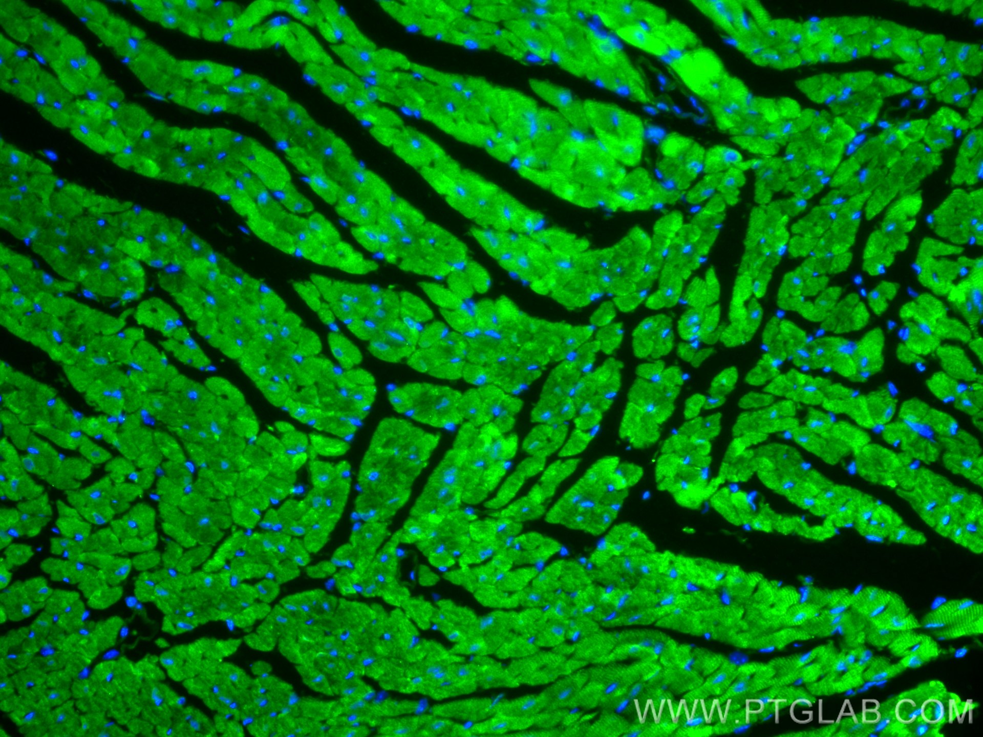 IF Staining of mouse heart using 16813-1-AP