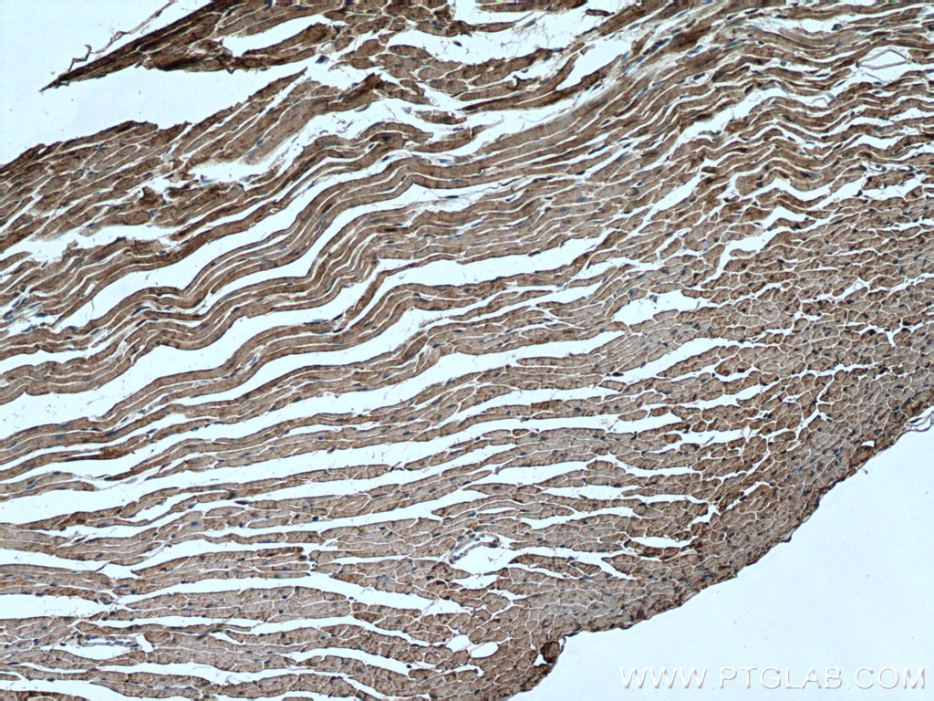IHC staining of mouse heart using 16813-1-AP