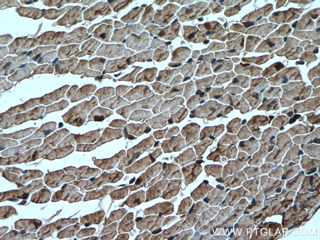 IHC staining of mouse heart using 16813-1-AP