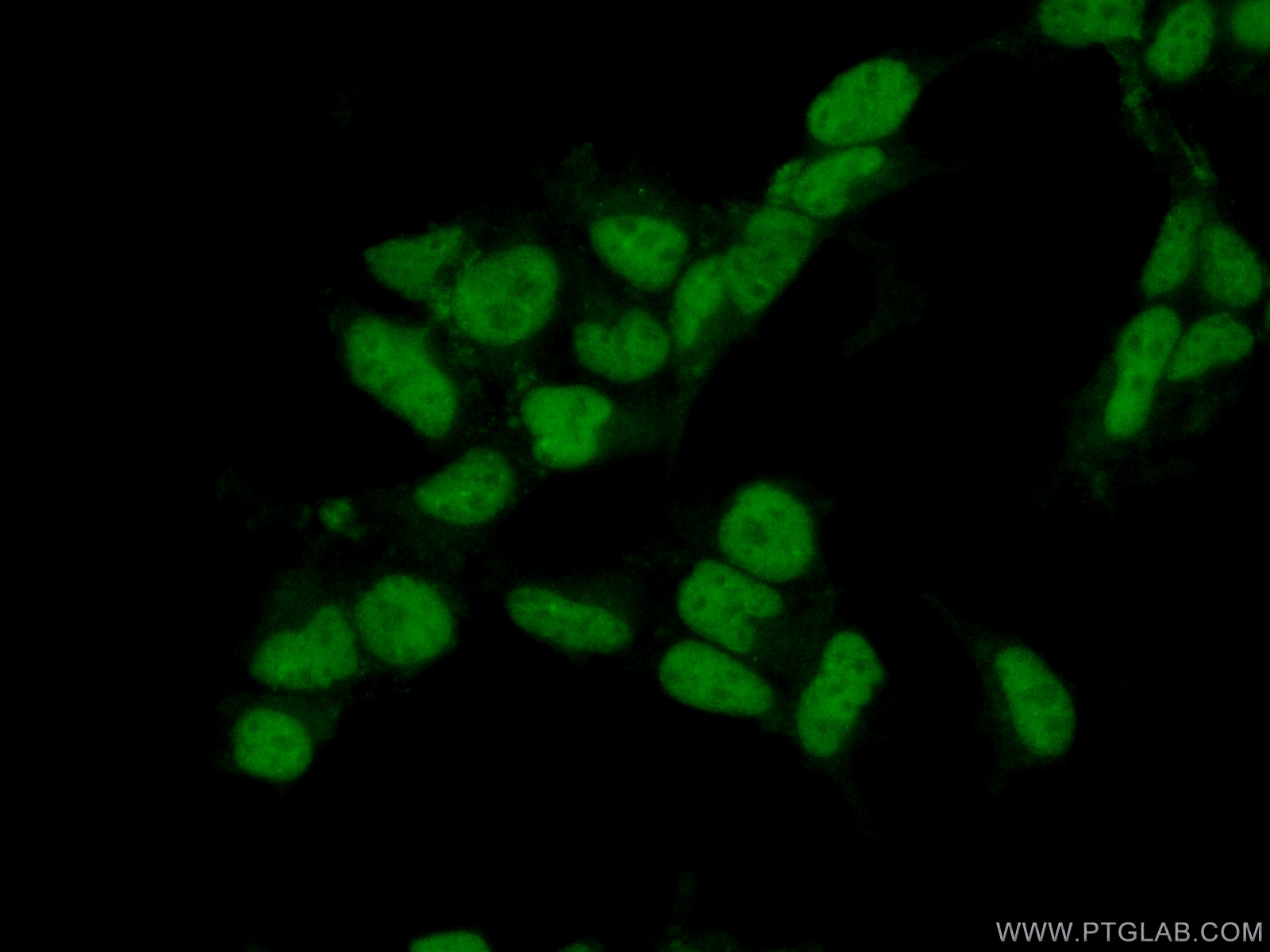 IF Staining of HEK-293 using 15287-1-AP