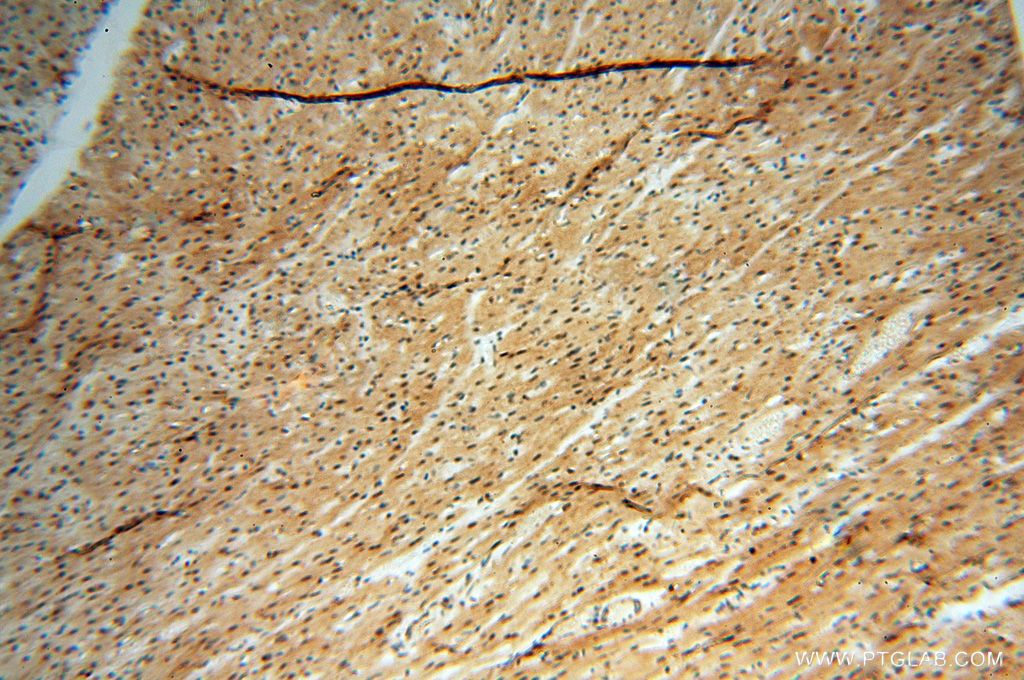 IHC staining of human heart using 15287-1-AP