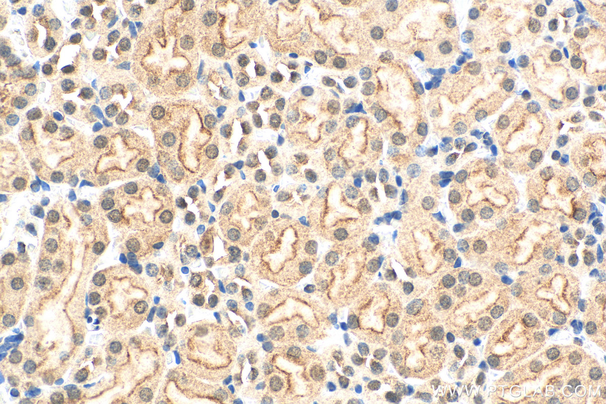 IHC staining of mouse kidney using 27631-1-AP