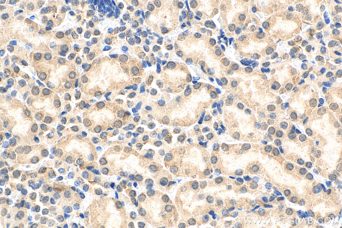 IHC staining of mouse kidney using 27771-1-AP
