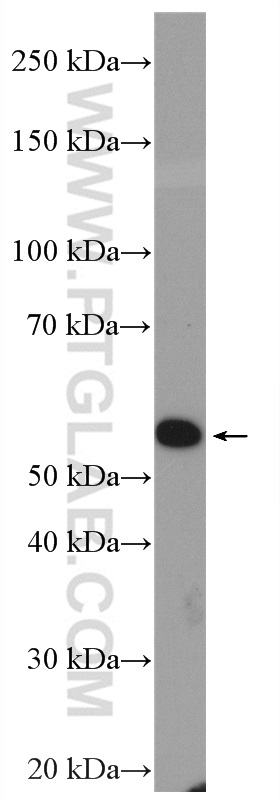 WB analysis of PC-3 using 27771-1-AP
