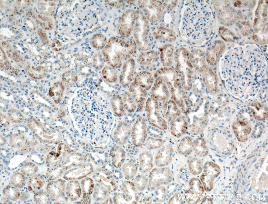 IHC staining of human kidney using 10211-1-AP