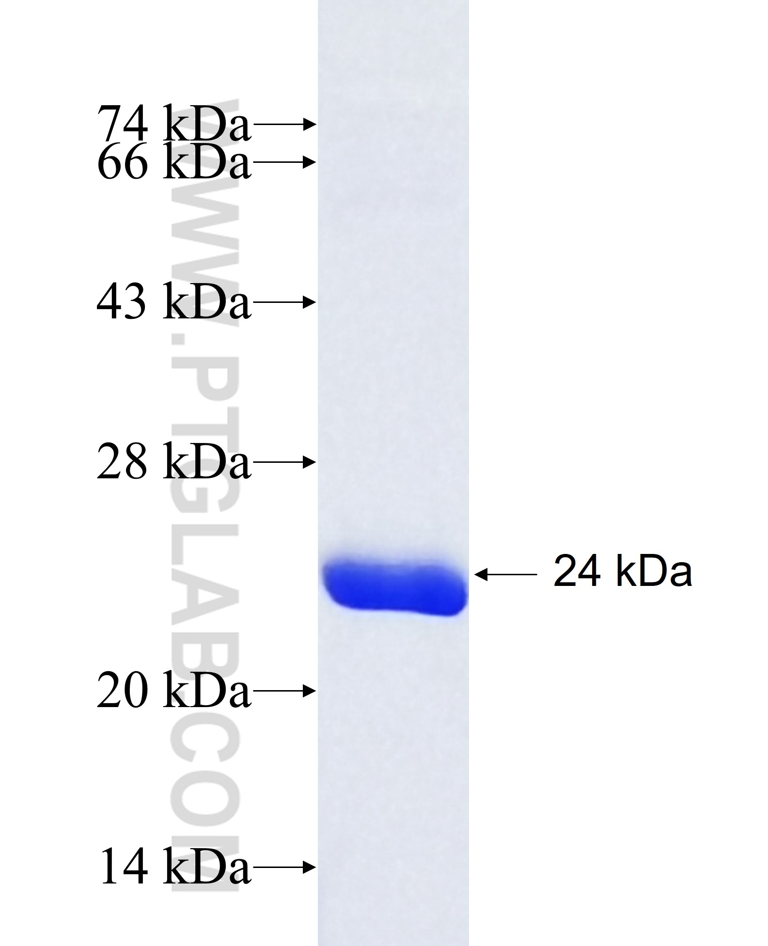 HSPC159 fusion protein Ag9935 SDS-PAGE