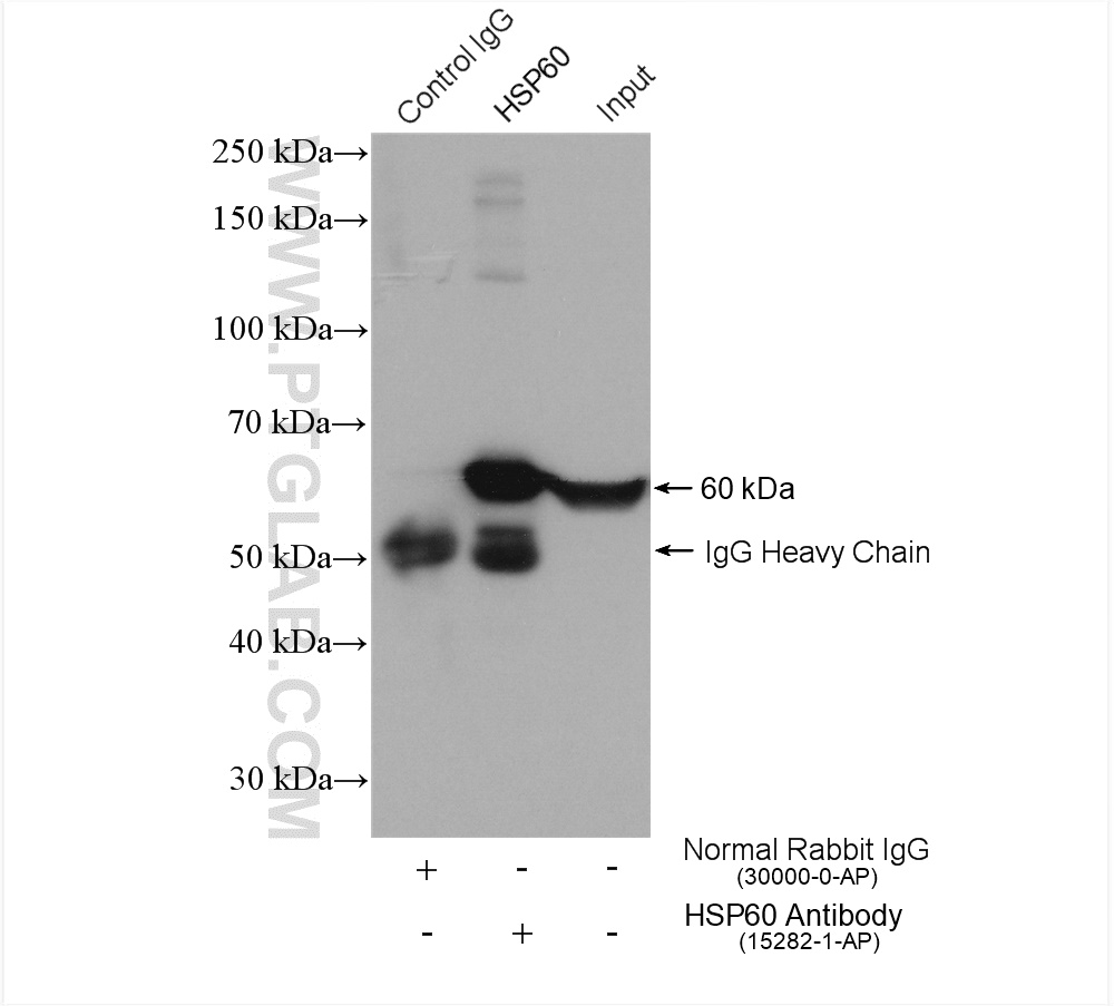 IP experiment of HEK-293 using 15282-1-AP