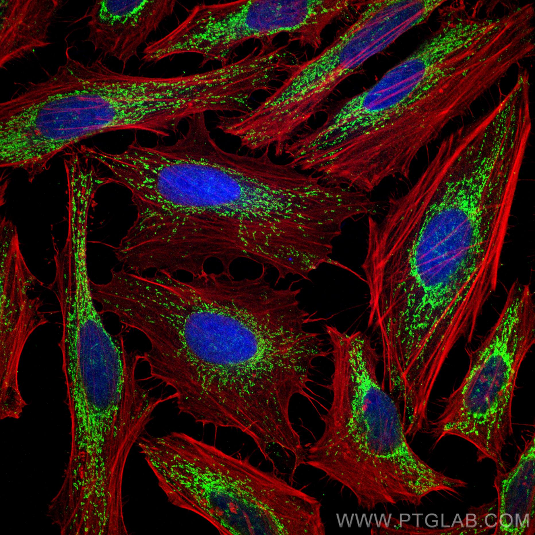 IF Staining of HeLa using 66041-1-Ig (same clone as 66041-1-PBS)