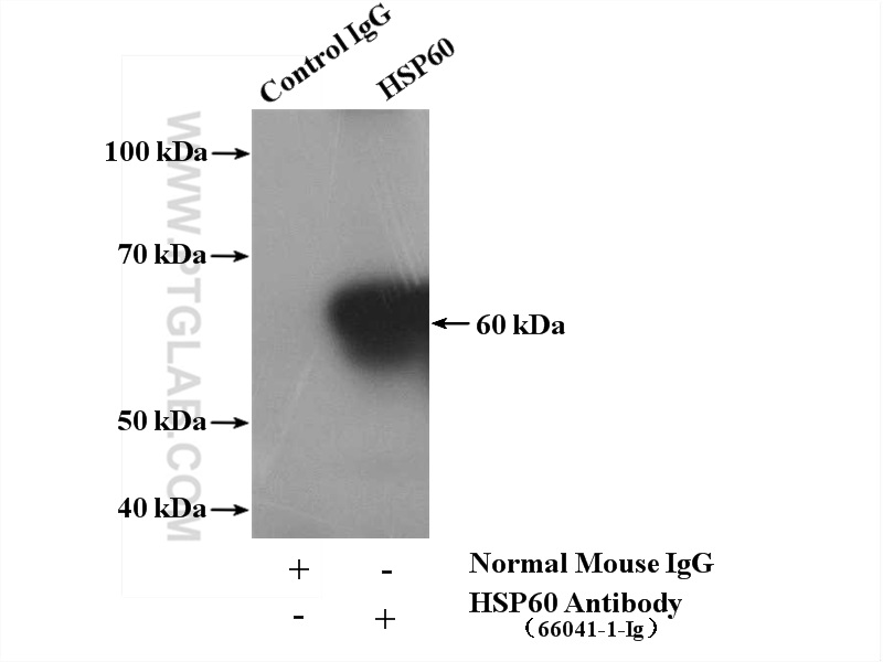 IP experiment of mouse liver using 66041-1-Ig (same clone as 66041-1-PBS)