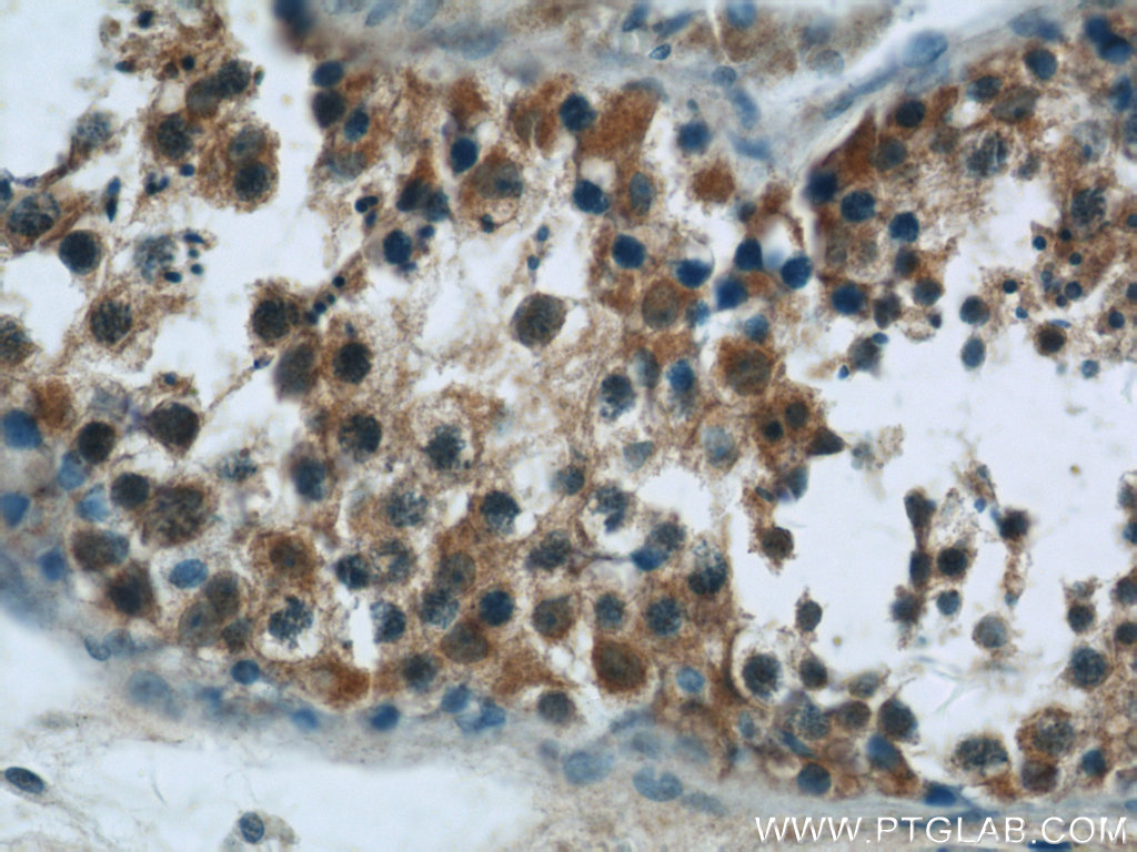 IHC staining of human testis using 13383-1-AP