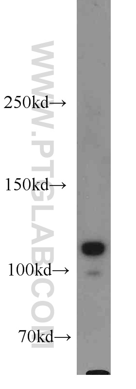 WB analysis of MCF-7 using 13383-1-AP