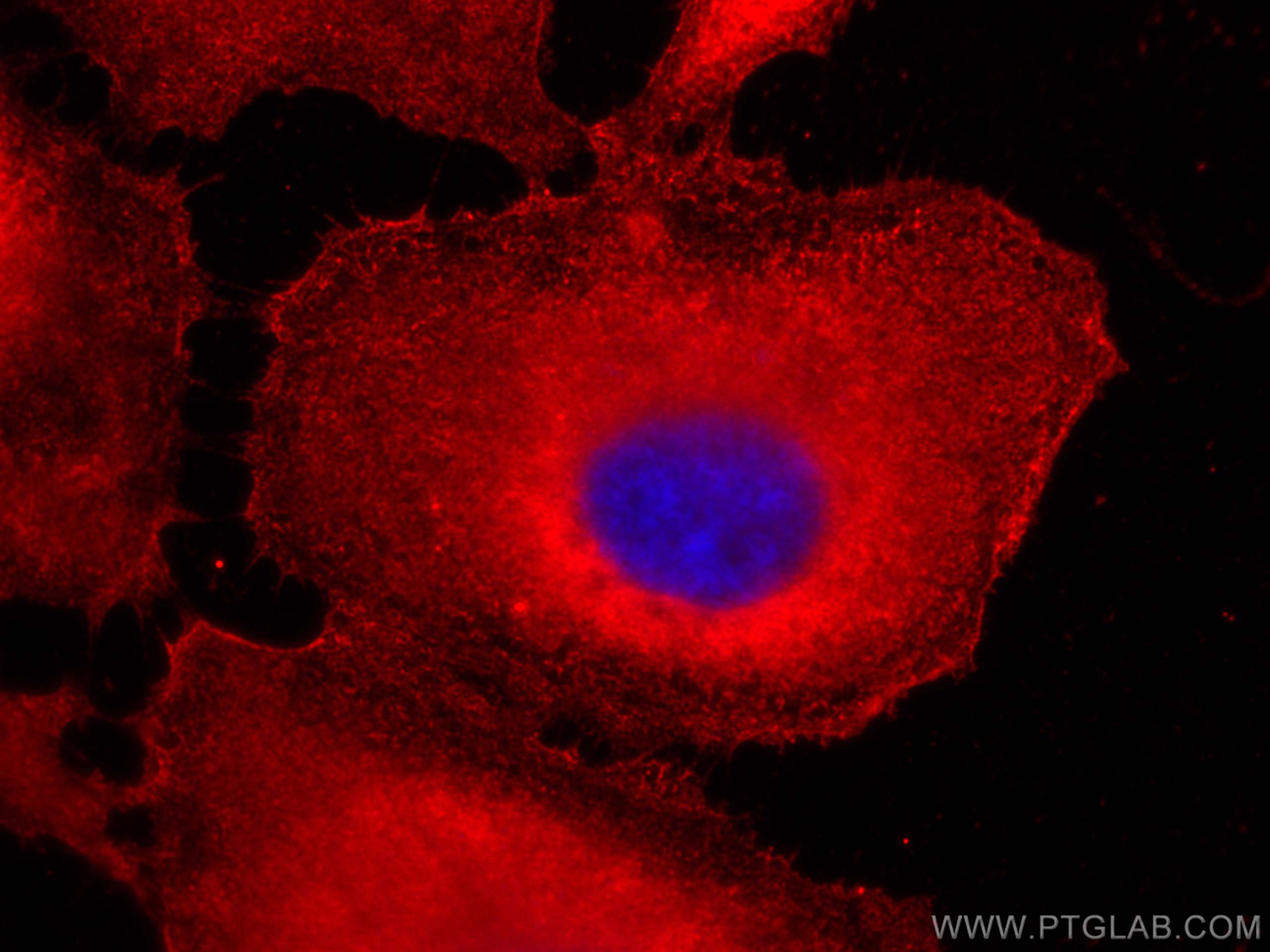 IF Staining of HeLa using CL594-66723