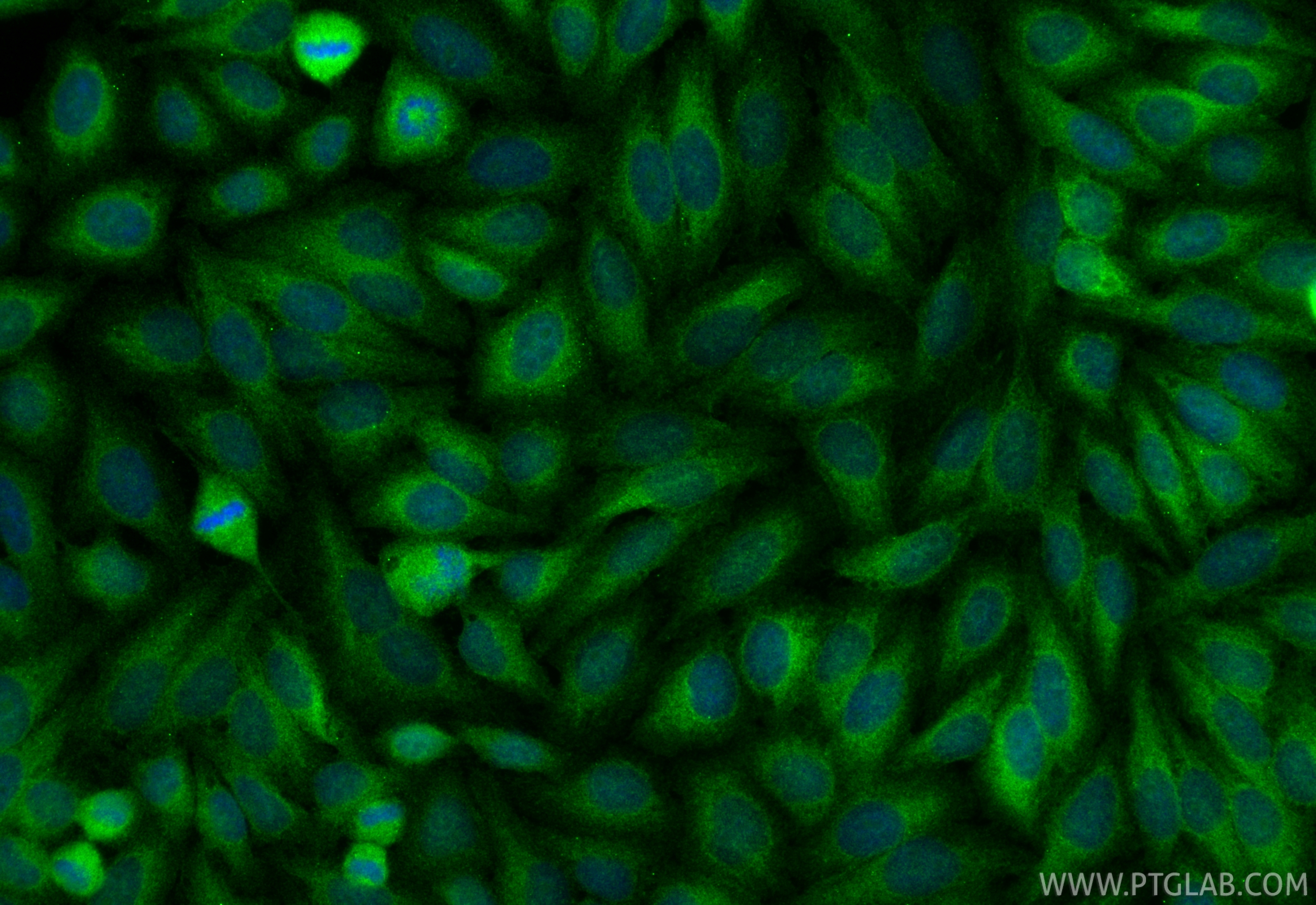 IF Staining of HepG2 using 10251-1-AP IF Staining of HepG2 using 10251-1-AP