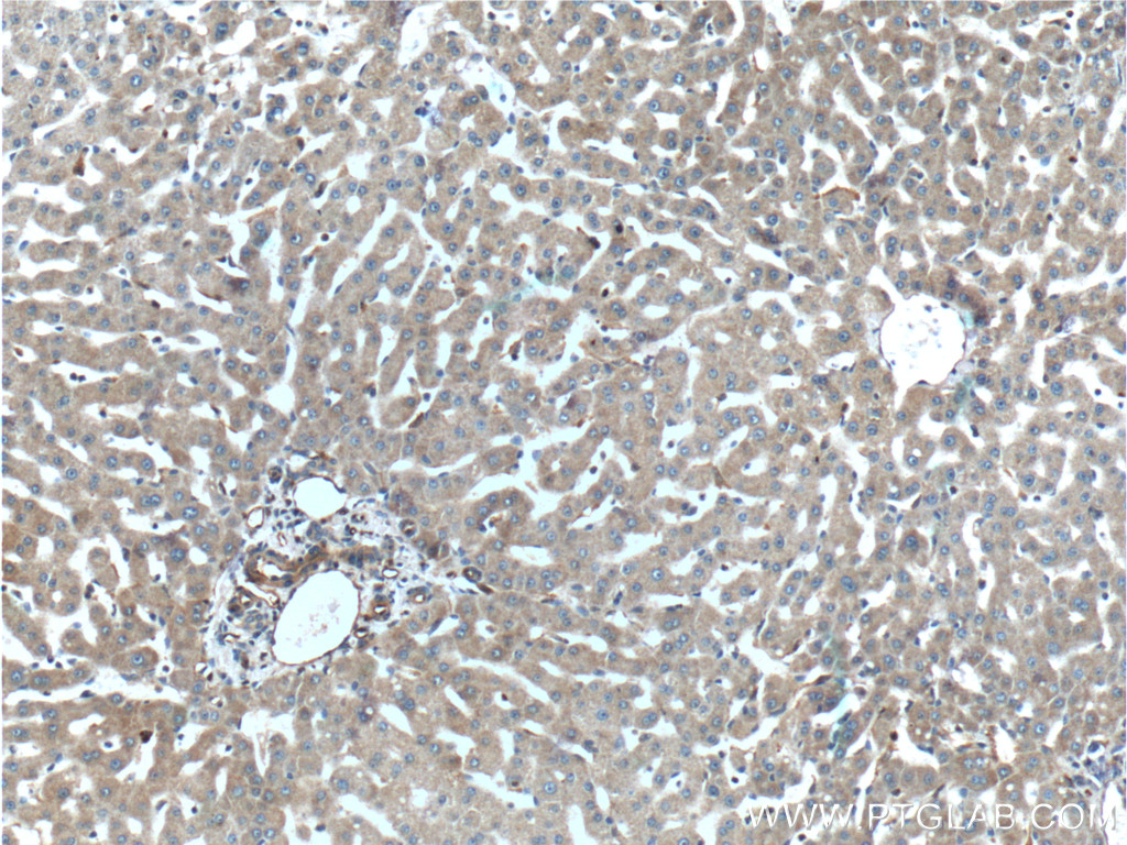 IHC staining of human liver using 10251-1-AP