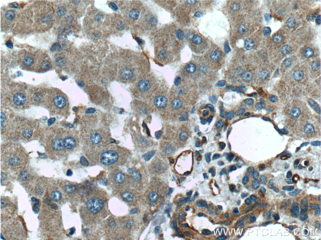 IHC staining of human liver using 10251-1-AP