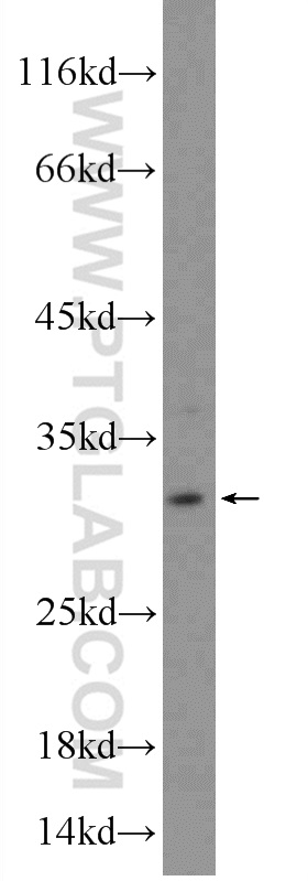 WB analysis of HeLa using 10251-1-AP