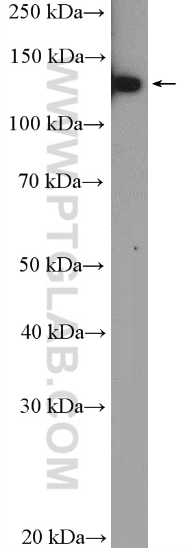 WB analysis of HeLa using 20805-1-AP